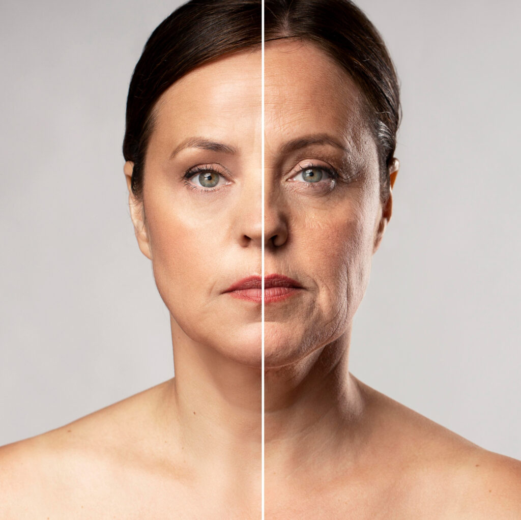 Lifting facial 1 Lifting facial