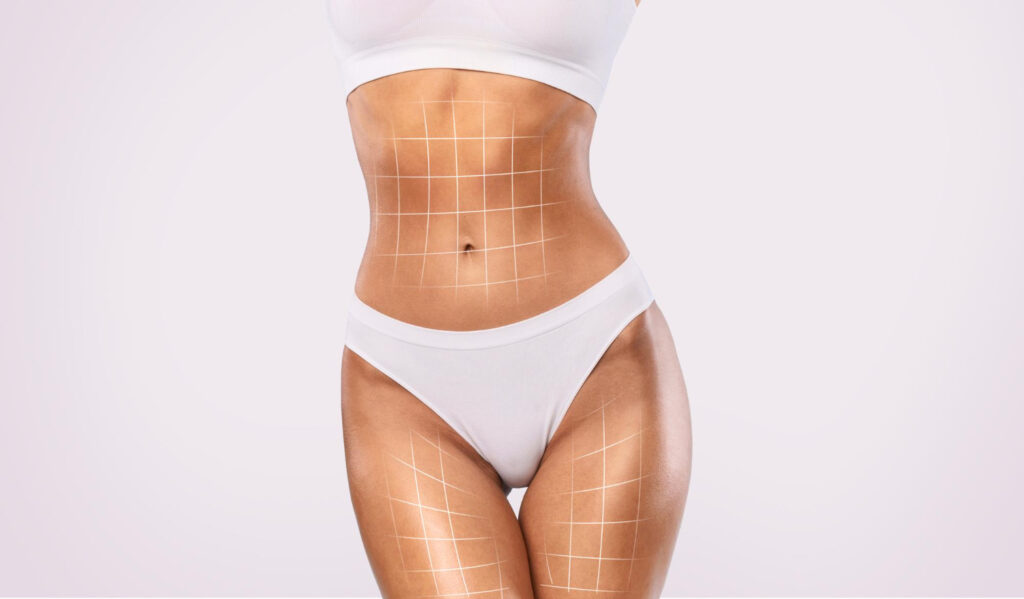 Lipoescultura HD