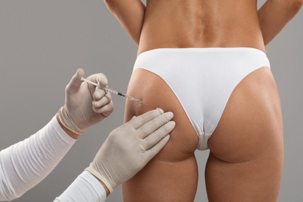  Lipotransferencia glútea.