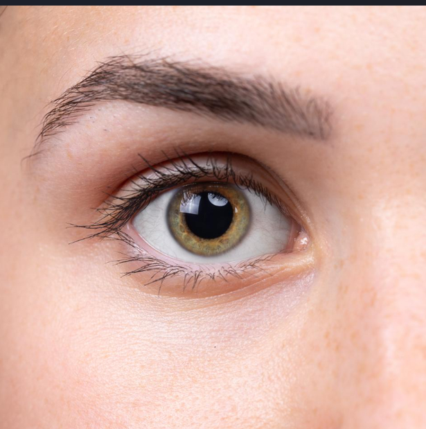 Blefaroplastia (Cirugía de Párpados)