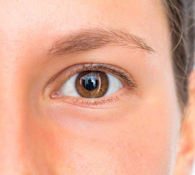 Blefaroplastia (Cirugía de Párpados)