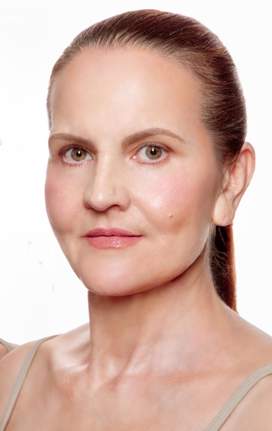 Lifting facial 5 Lifting facial